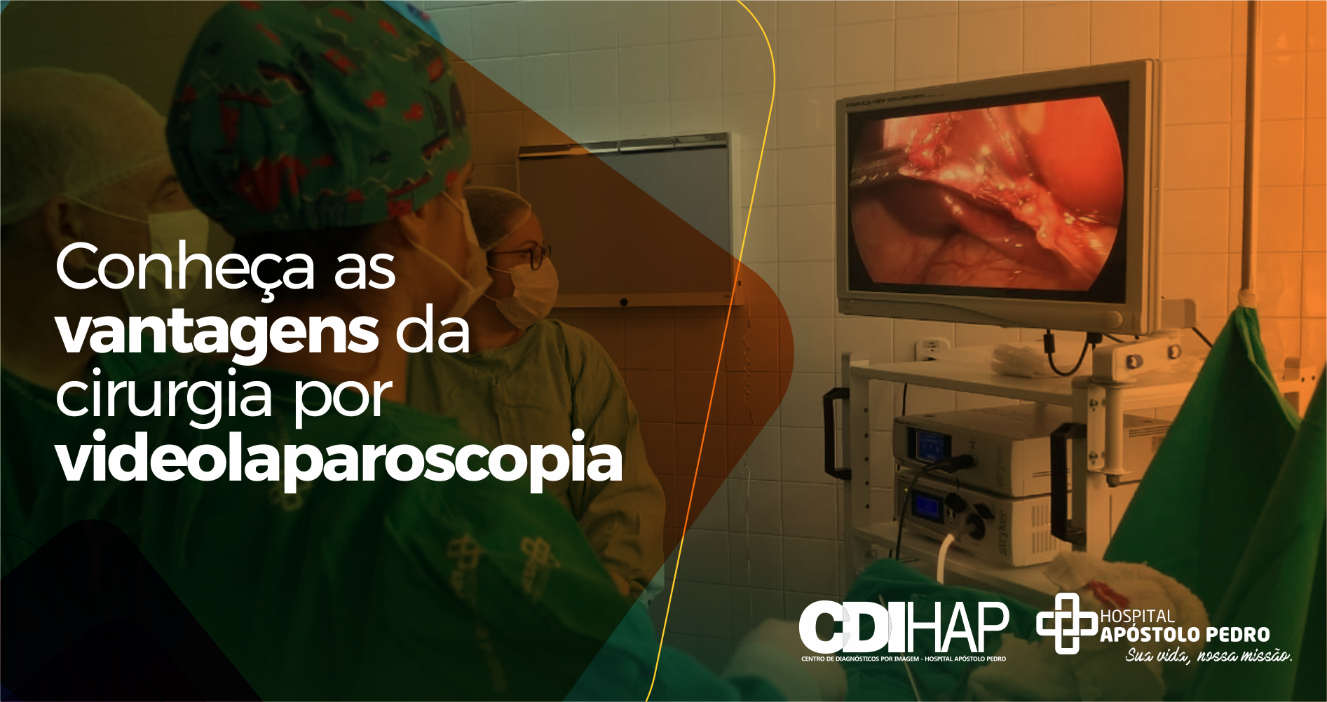 QUAIS AS VANTAGENS DA LAPAROSCOPIA EM RELAÇÃO A CIRURGIA CONVENCIONAL?